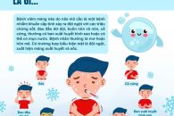 NHẬN BIẾT SỚM VÀ PHÒNG NGỪA BỆNH VIÊM MÀNG NÃO DO NÃO MÔ CẦU